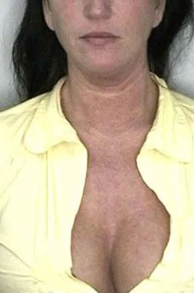Kristin Grønlund